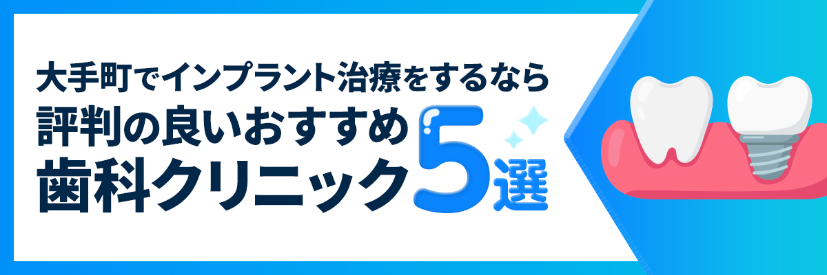 大手町でインプラント治療をするなら評判の良いおすすめ歯科クリニック5選